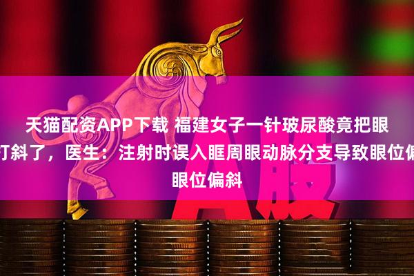 天猫配资APP下载 福建女子一针玻尿酸竟把眼睛打斜了，医生：注射时误入眶周眼动脉分支导致眼位偏斜
